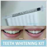 Zoom Real Kit2 Tooth Whitening Kit